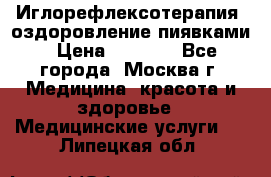 Иглорефлексотерапия, оздоровление пиявками › Цена ­ 3 000 - Все города, Москва г. Медицина, красота и здоровье » Медицинские услуги   . Липецкая обл.